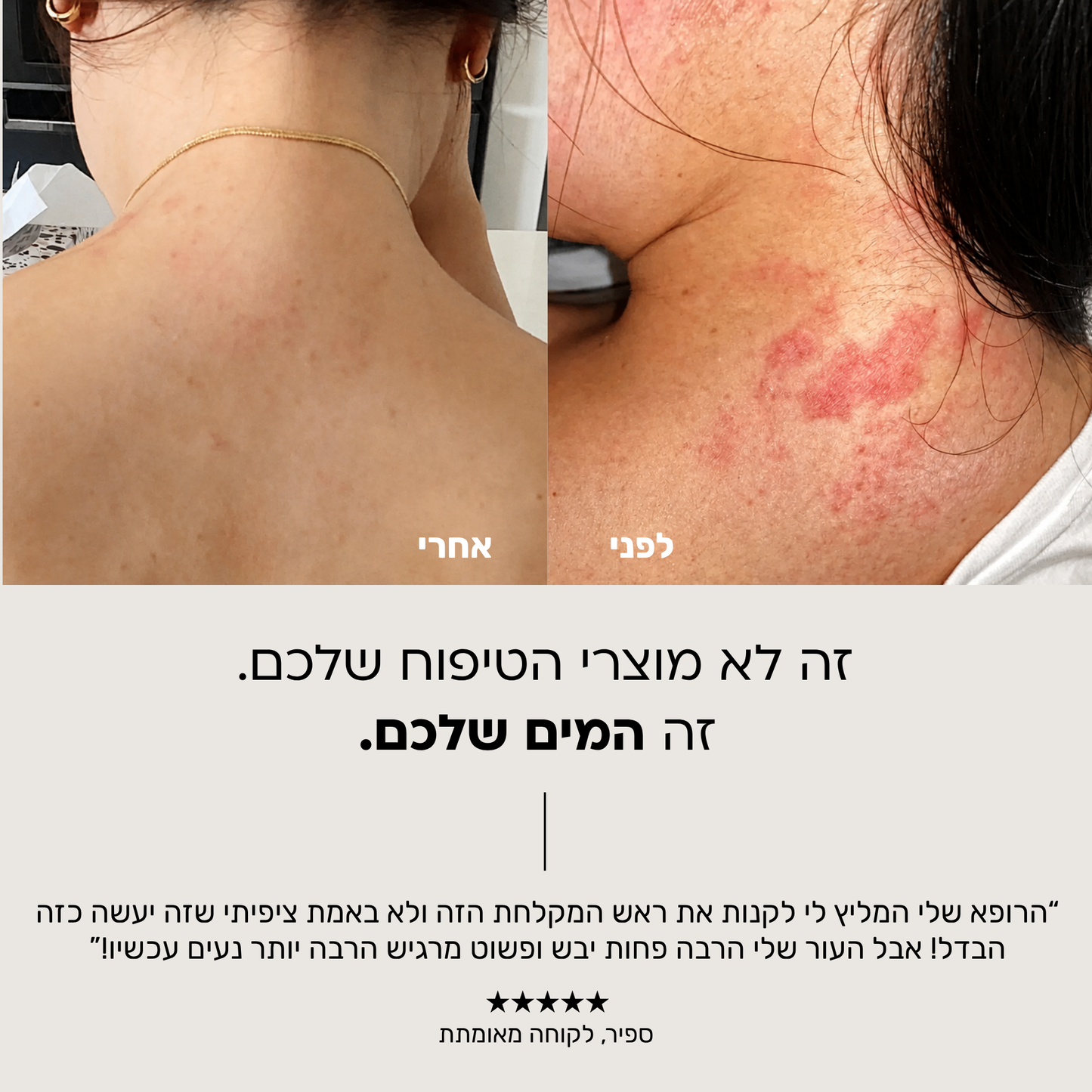 THERAVE AQUA | ראש מקלחת מסנן